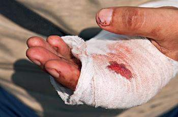 Dog Bite Finger Numb Dog Bite Finger Numb