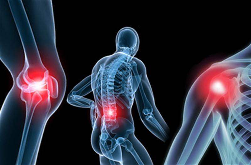 Kalça Osteoartriti Kalça Osteoartriti