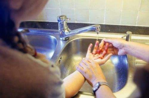 Yara Bakımı Tedavisi