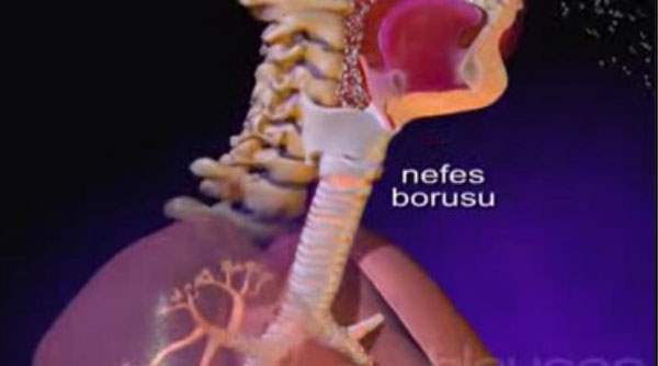 Bronşiyal Adenoma