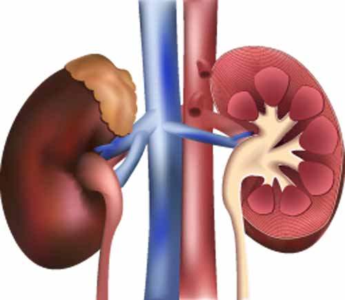 Araştırma Yaşayan Böbrek Donörlerinde Metabolik Sendromun Kalan Böbreğin Fonksiyonunu Kötüleştirdiğini Buldu