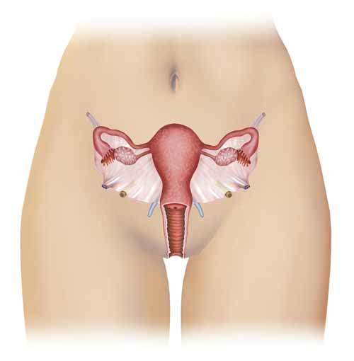 Genital Uçuk Neye Benzer?