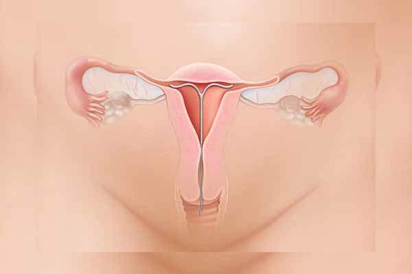 Endometriyoz - Neler Olur?