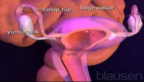 Endometriyoz için Diğer Tedaviler