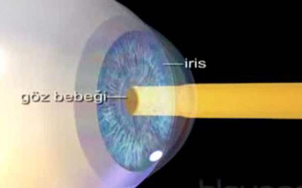 İris