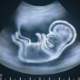 Hamileliğin 9. haftasında bebeğin organlarının durumu nedir?