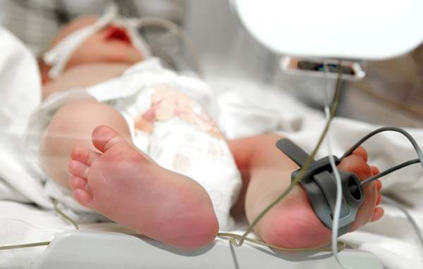 Her Yıl 13 Milyon Bebek Prematüre Olarak Doğuyor