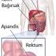 Çocuklarda apandisit daha çabuk patlıyor