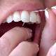 Diş ipini kullanma sıklığı ne olmalıdır?