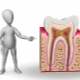 Kırılan dişin tedavisi nedir?