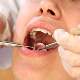 Ortodonti tedavisi sırasında nelere dikkat edilmelidir?