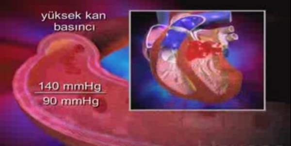 3 Kişiden Birinde Hipertansiyon Var