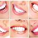 Karbonat dişleri beyazlatır mı?