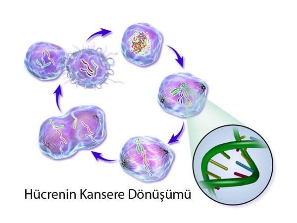 Kanser Tedavisinde Sıcak Kemoterapi Yöntemi