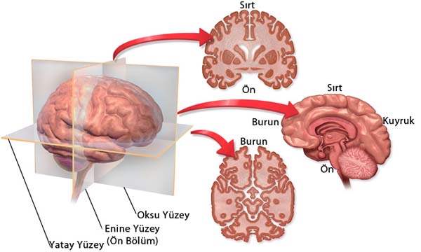 Epifiz bezi nedir?