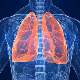 Akciğer Embolisi Nedir?