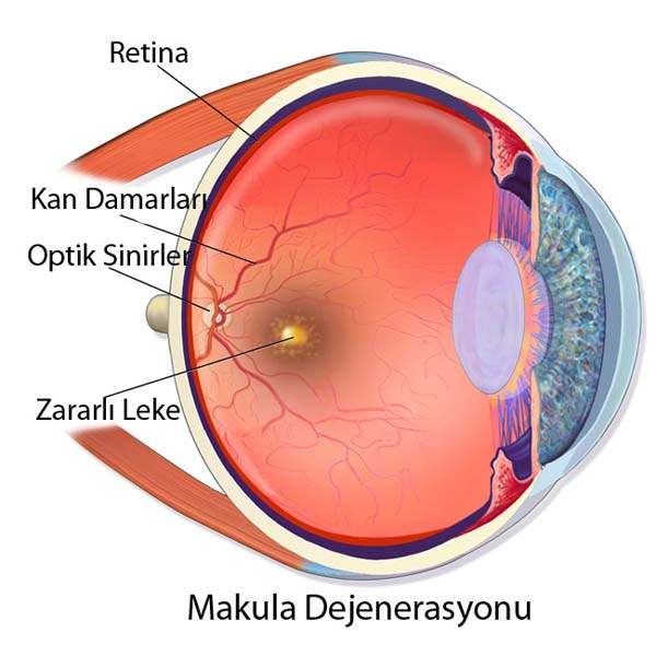 Sarı Nokta Hastalığının Belirtileri