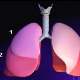 Akciğer kanserinin evreleri