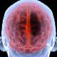 İyi huylu beyin tümörlerinin zararları
