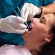 Diş implantı takılırken acı verir mi?