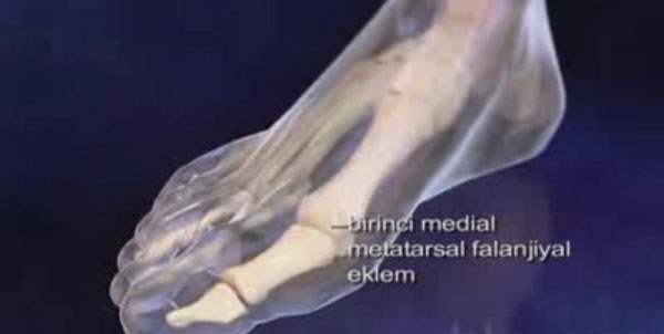 Ayak
