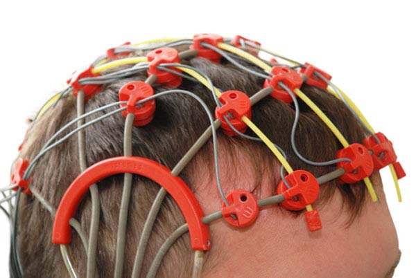 Epilepsi (Sara) Tedavisi