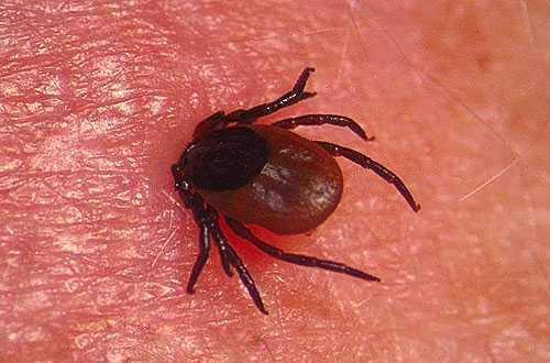 Lyme Hastalığı: Nedenleri, Belirtileri ve Tedavisi