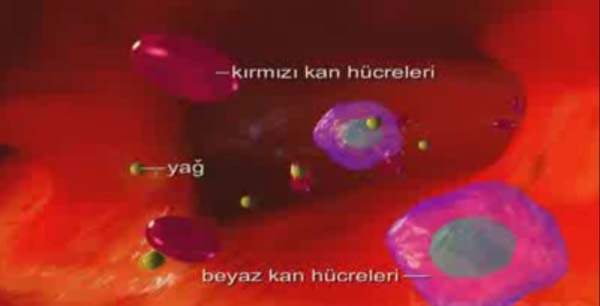Orak Hücre Hastalığı
