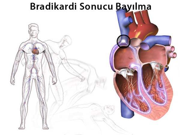 Yavaş Kalp Atımı: Bradikardi