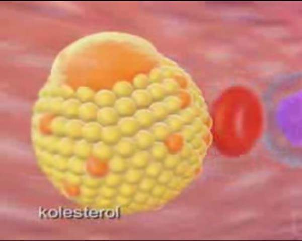 HDL - İyi Kolesterol Nasıl Yükseltilir