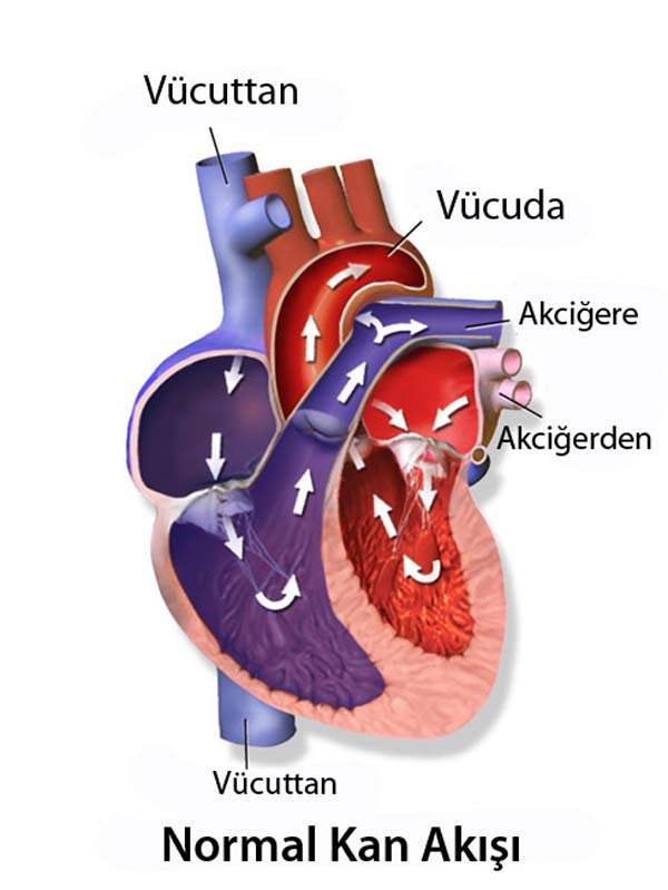 Atrial Çırpınımın Neden Olduğu Hastalıklar