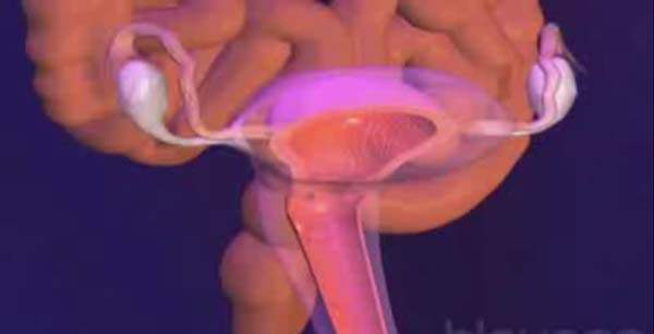 Vulva Kanseri
