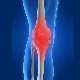 Romatoid Artritin Nedenleri