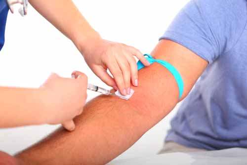 HIV Testi