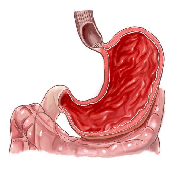 Gastroparazi
