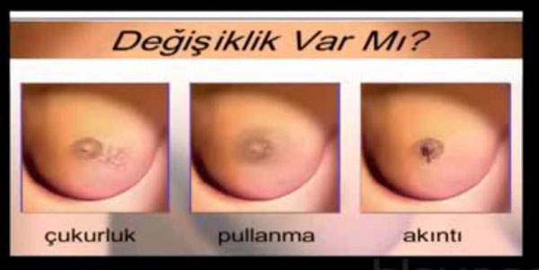 Meme Başı Akıntısı