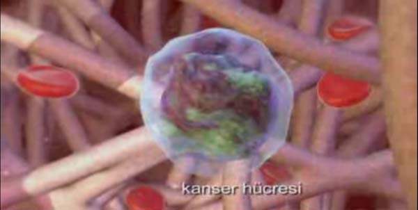Rahim (Endometrial) Kanseri