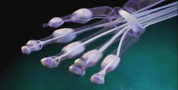Osteokondritis Dissekans