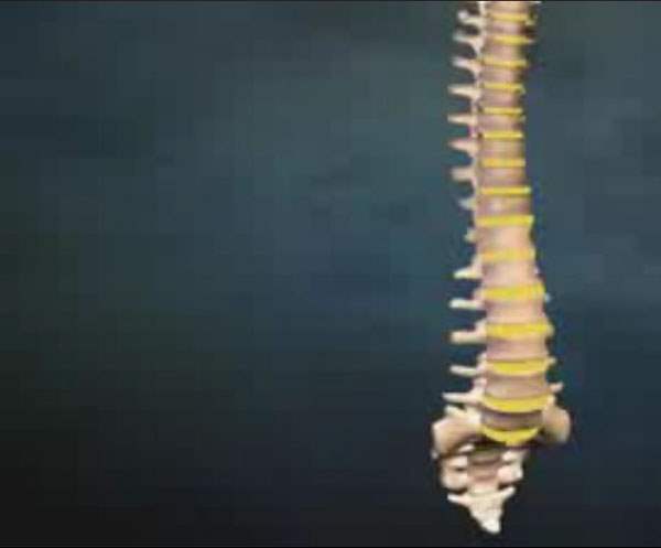 Miyelografi