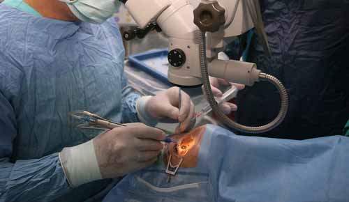 Lasik Tedavisi Öncesi ve Sonrası