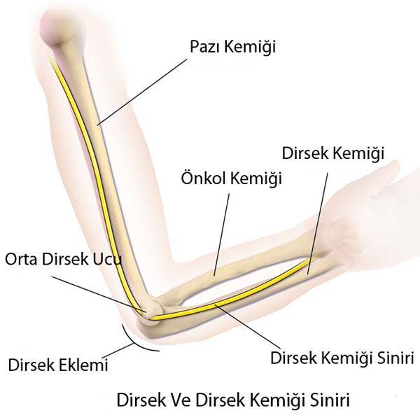 Ulnar Sinir Sıkışması