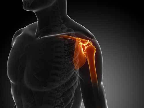 Rotator Manşet Yırtıkları (Omuz döndürücü tendon manşeti yırtıkları)