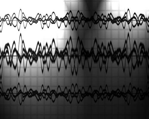 Elektroensefalogram (EEG)