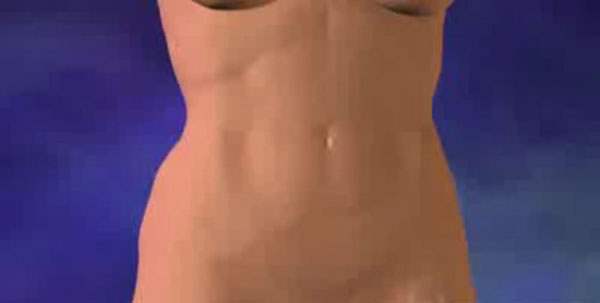 Karın Gerdirme (Abdominoplasti)