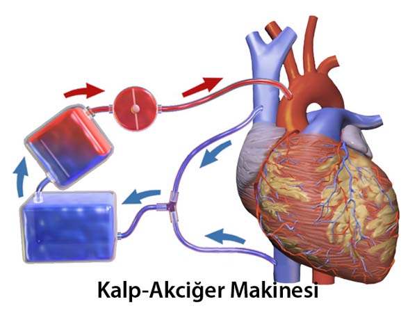 Atriyal Çırpınımın Neden Olduğu Hastalıklar
