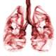 Akciğer Nodülü Nedir?