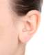 Orta Kulak Kireçlenmesi (Otoskleroz) ve Belirtileri