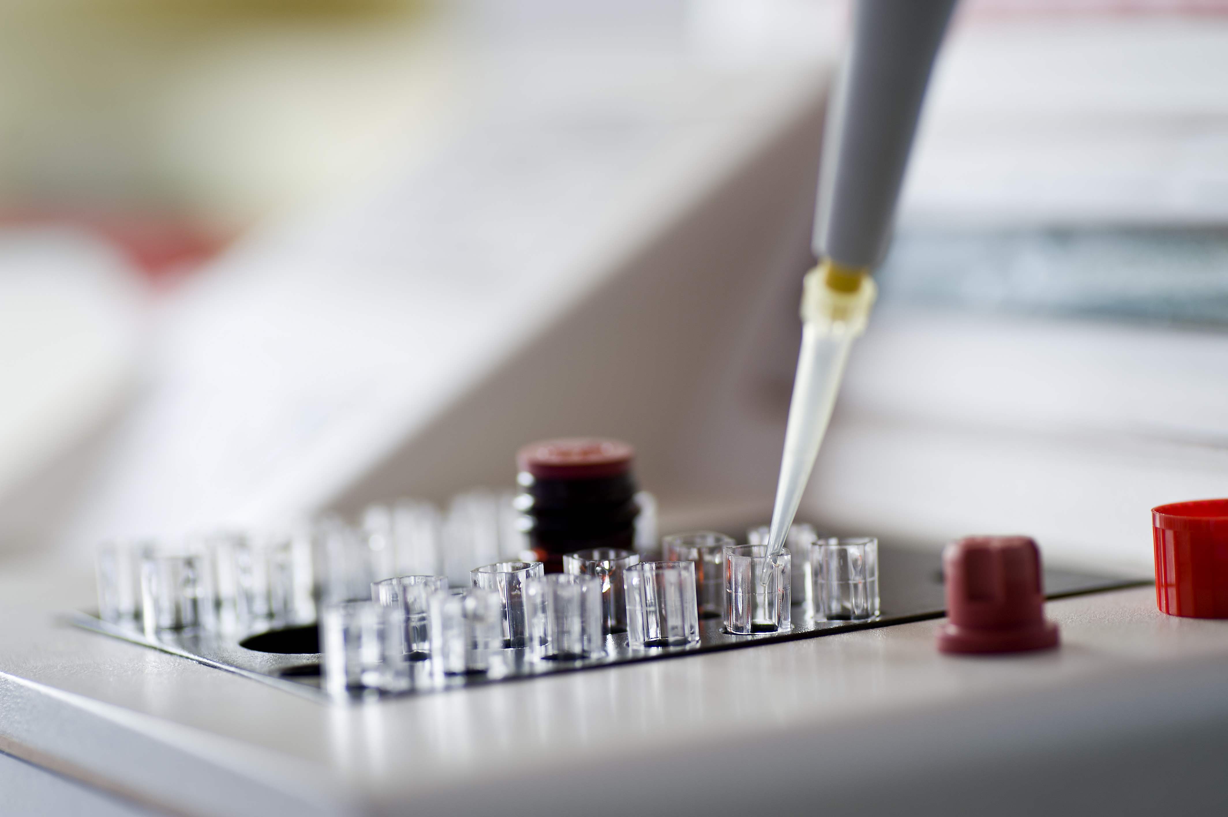 Smear Testi