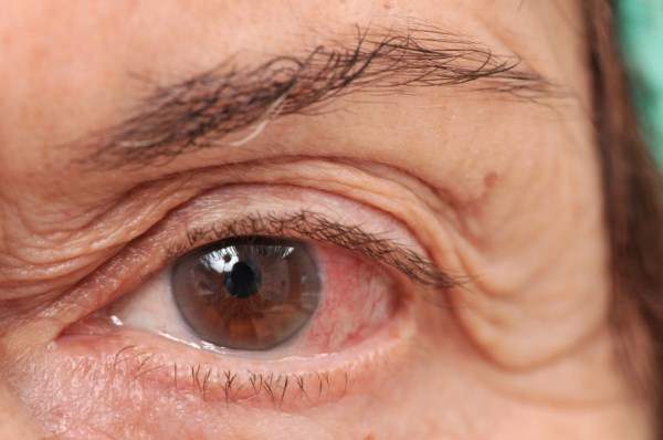 Alzheimer Hastalığında Görme Problemleri