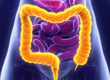 Ülseratif Kolit ve Crohn Hastalığı Arasındaki Farklar